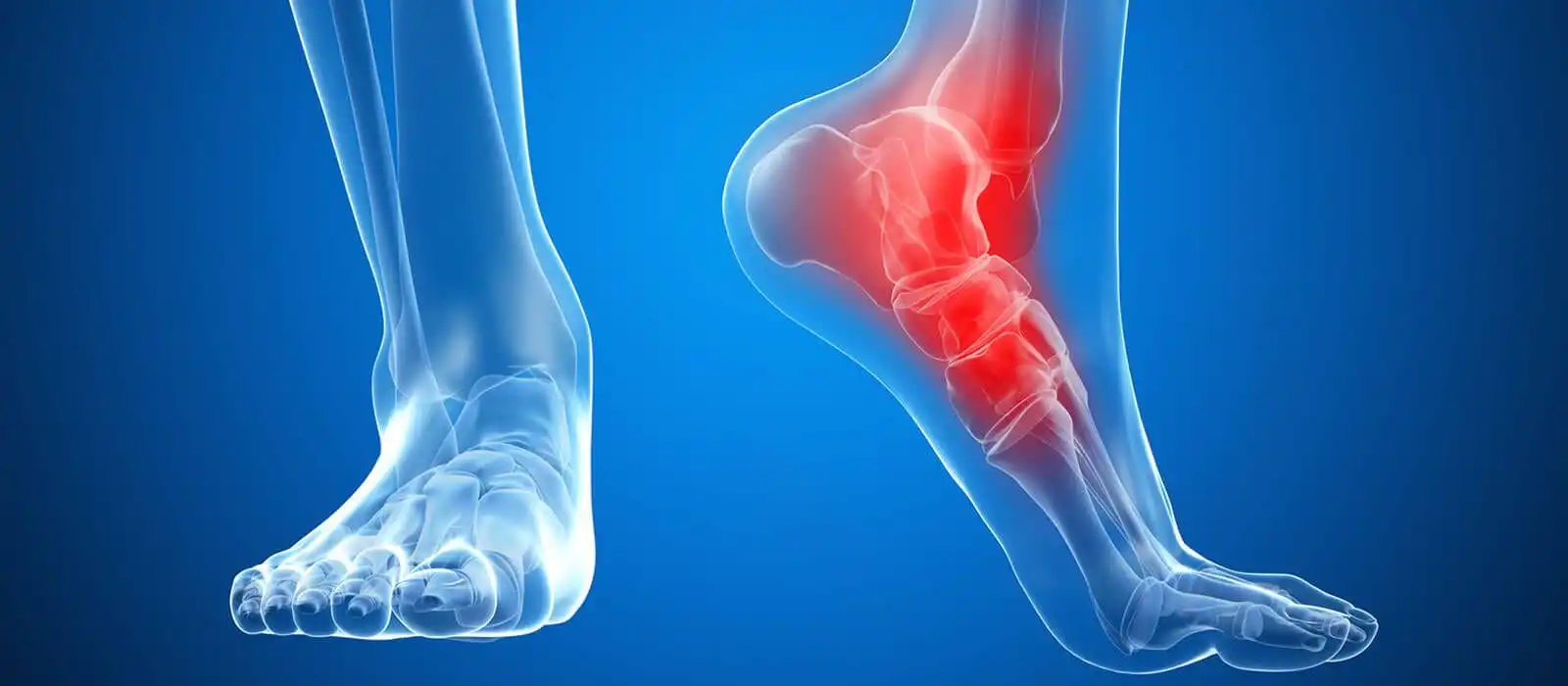 Переломы голеностопного сустава и стопы — Physiotherapist Переломы голеностопного сустава и стопы