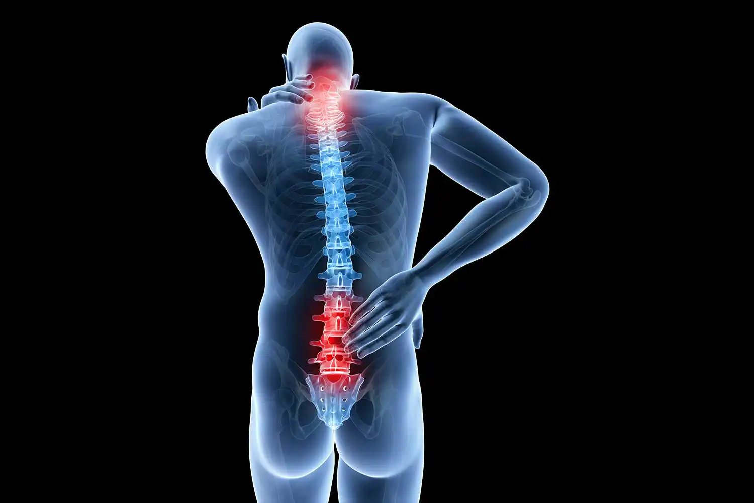 Фасеточный синдром — Physiotherapist Фасеточный синдром
