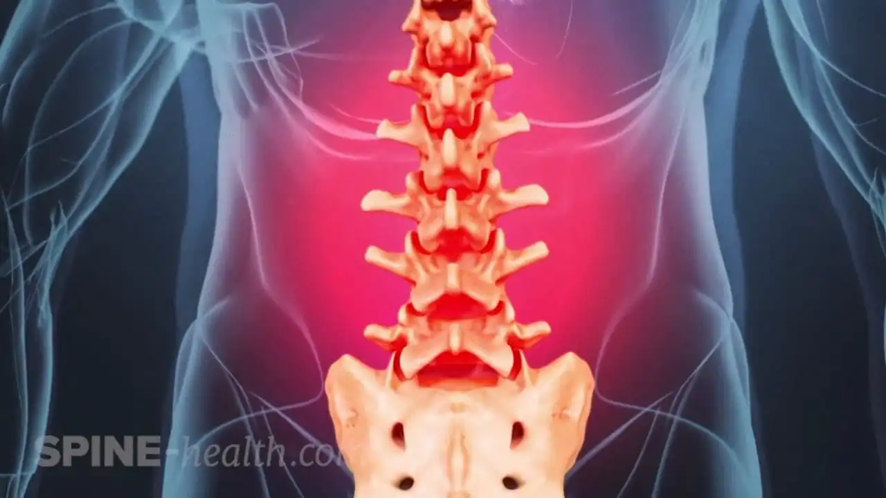 Неспецифическая боль в пояснице — Physiotherapist Неспецифическая боль в пояснице