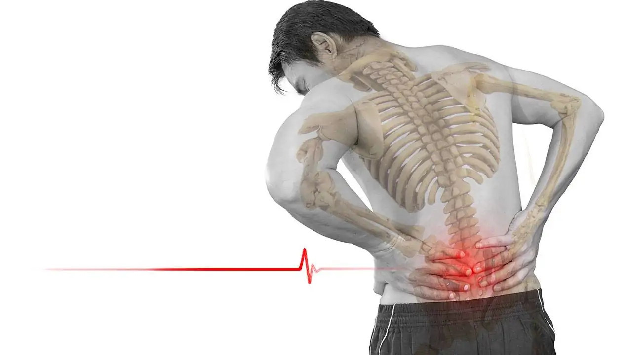 Неспецифическая боль в пояснице — Physiotherapist Неспецифическая боль в пояснице