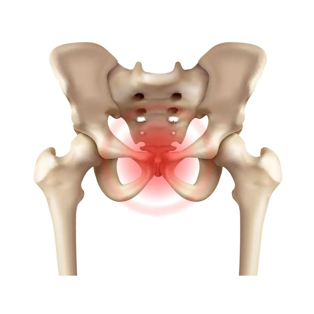 Дисфункция лобкового симфиза — Physiotherapist Дисфункция лобкового симфиза