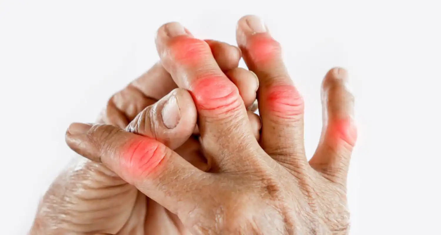 Триггерный палец — Physiotherapist Триггерный палец