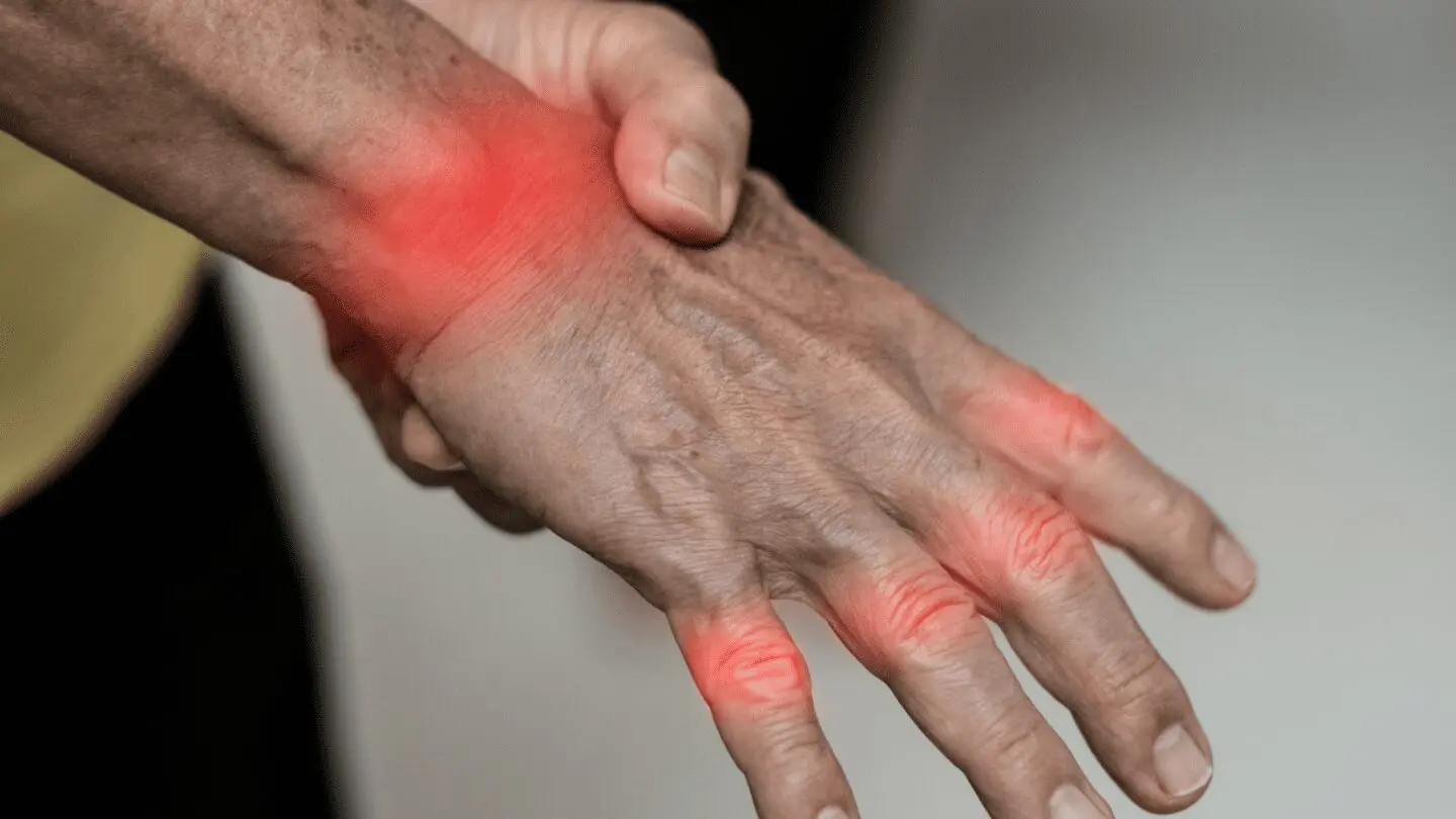Остеоартроз запястья и кисти — Physiotherapist Остеоартроз запястья и кисти