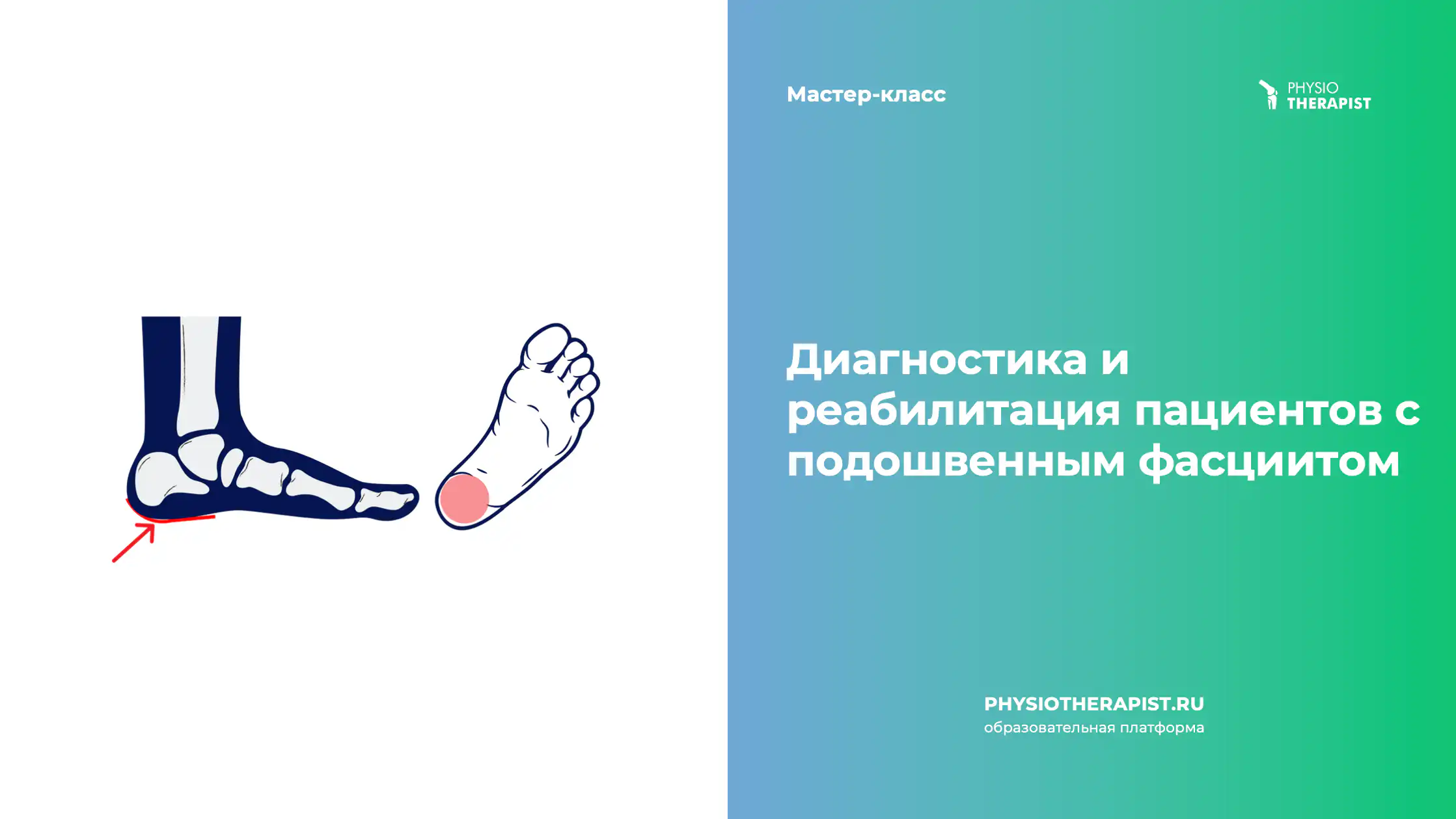 Диагностика и реабилитация пациентов с подошвенным фасциитом