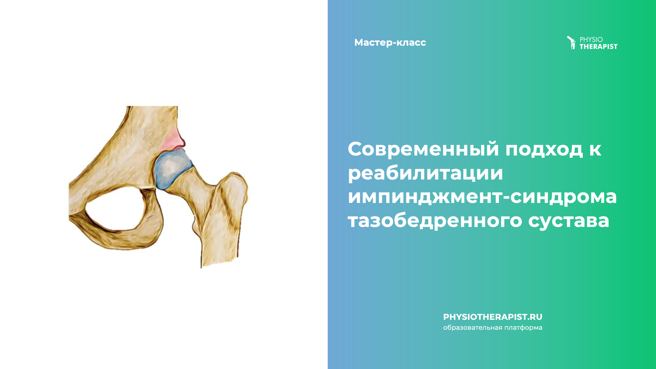 Современный подход к реабилитации импинджмент-синдрома тазобедренного сустава