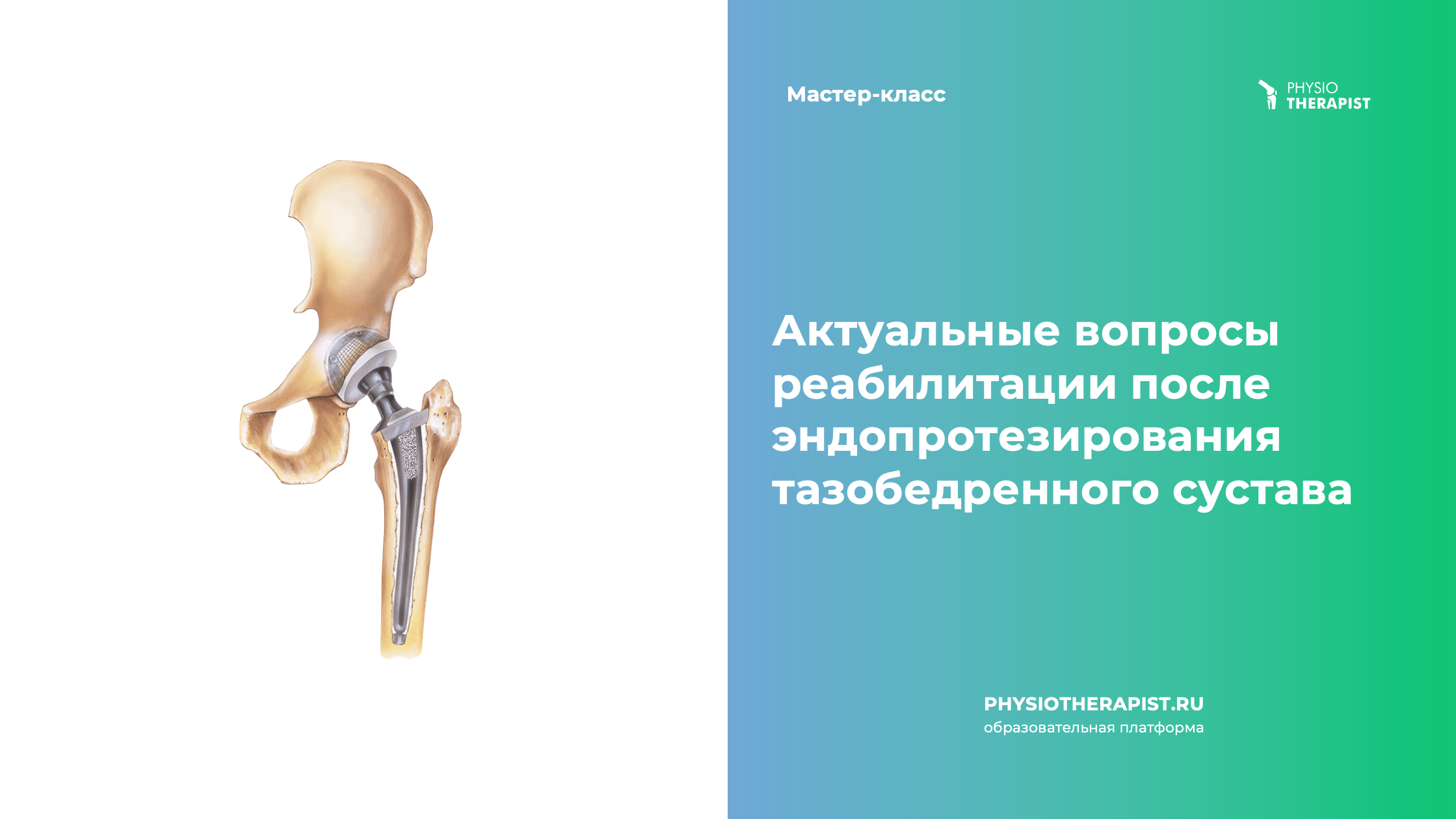 Актуальные вопросы реабилитации после эндопротезирования тазобедренного сустава