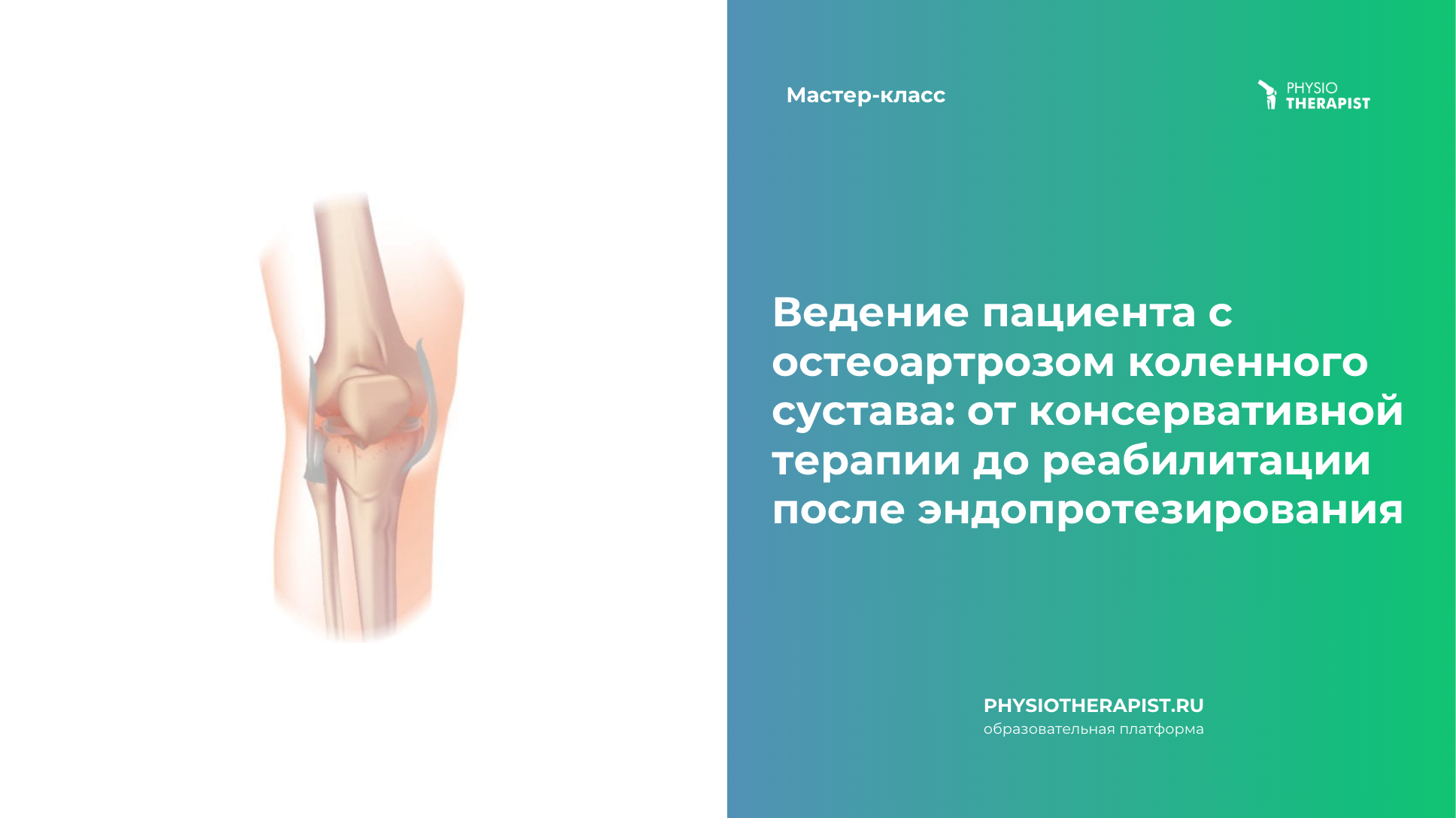 Ведение пациента с остеоартрозом коленного сустава